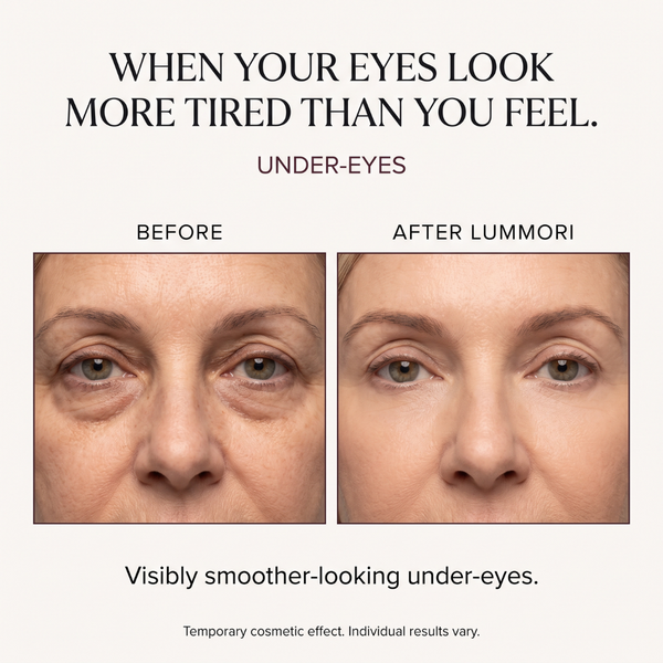 UNDER-EYES